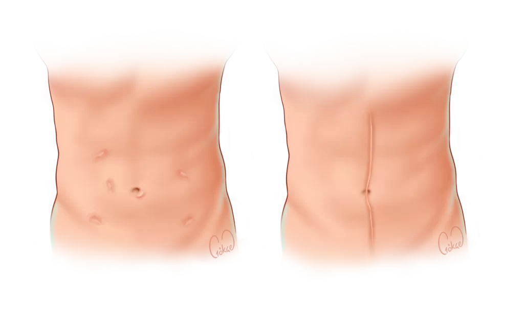 surgery