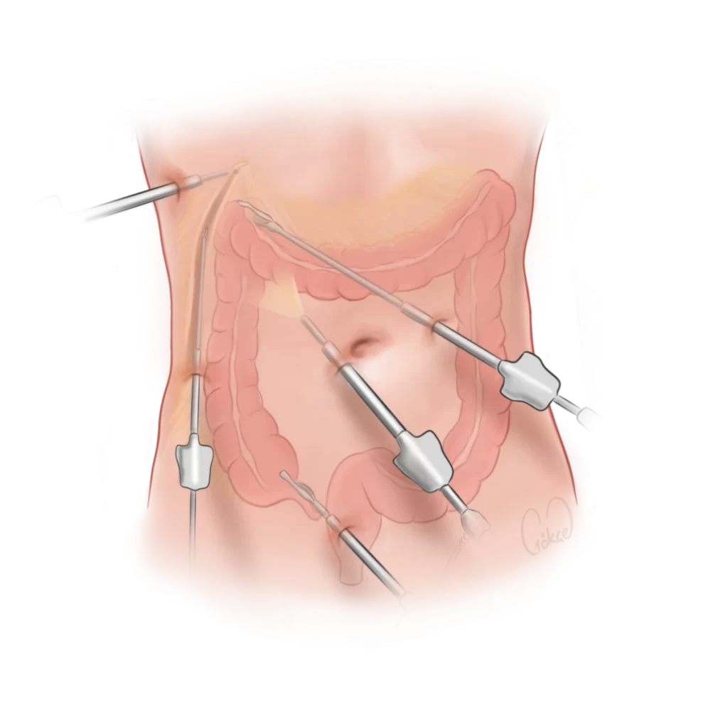 dissection