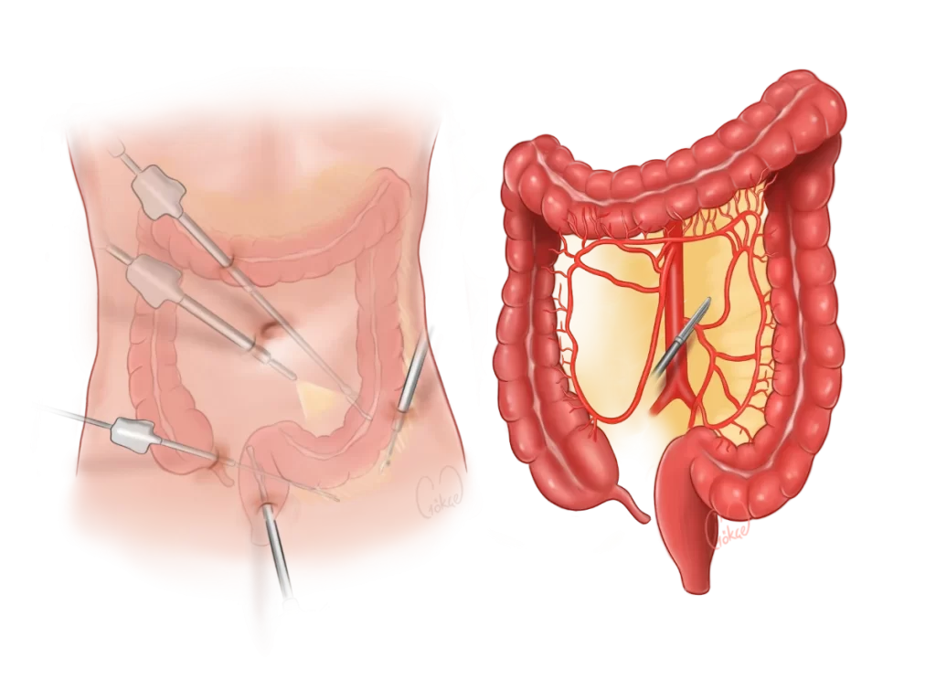 dissection2